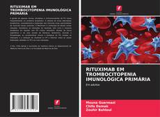 Bookcover of RITUXIMAB EM TROMBOCITOPENIA IMUNOLÓGICA PRIMÁRIA