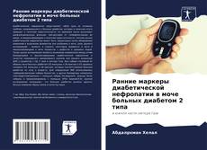 Bookcover of Ранние маркеры диабетической нефропатии в моче больных диабетом 2 типа