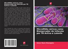 Buchcover von MicroRNAs séricos como Biomarcador de Infecção por TB Activa e Latente