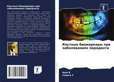 Capa do livro de Костные биомаркеры при заболеваниях пародонта 