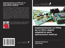 Capa do livro de Implementación en FPGA de un filtro digital adaptativo para aplicaciones médicas 