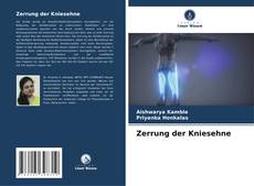 Bookcover of Zerrung der Kniesehne