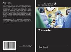 Bookcover of Trasplante