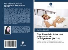 Capa do livro de Eine Übersicht über das polyzystische Ovarsyndrom (PCOS) 