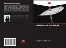 Bookcover of Orthodontie accélérée