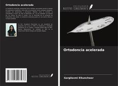 Capa do livro de Ortodoncia acelerada 