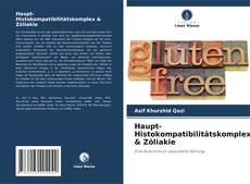 Buchcover von Haupt-Histokompatibilitätskomplex & Zöliakie
