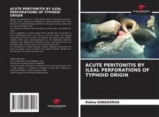 Capa do livro de ACUTE PERITONITIS BY ILEAL PERFORATIONS OF TYPHOID ORIGIN 