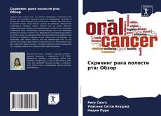 Bookcover of Скрининг рака полости рта: Обзор