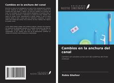 Bookcover of Cambios en la anchura del canal