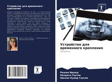 Устройство для временного крепления kitap kapağı