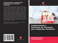 Bookcover of Conhecimento e Aceitação de Pacientes para Implantes Dentários