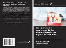 Copertina di Conocimiento y aceptación de los pacientes hacia los implantes dentales