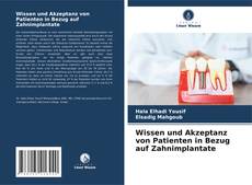 Capa do livro de Wissen und Akzeptanz von Patienten in Bezug auf Zahnimplantate 