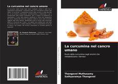 Buchcover von La curcumina nel cancro umano