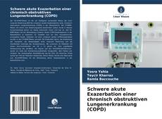 Buchcover von Schwere akute Exazerbation einer chronisch obstruktiven Lungenerkrankung (COPD)