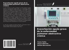 Copertina di Exacerbación aguda grave de la enfermedad pulmonar obstructiva crónica