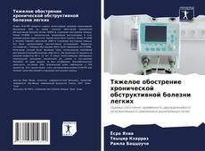 Обложка Тяжелое обострение хронической обструктивной болезни легких