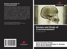 Couverture de Review and Study of Craniosynostosis