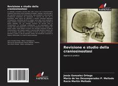 Revisione e studio della craniosinostosi kitap kapağı