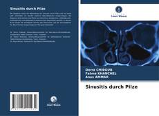 Bookcover of Sinusitis durch Pilze