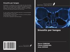 Copertina di Sinusitis por hongos