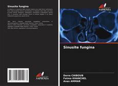 Capa do livro de Sinusite fungina 