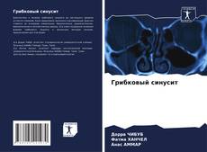 Borítókép a  Грибковый синусит - hoz