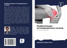 Реабилитация остеоартрозного колена kitap kapağı