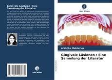 Bookcover of Gingivale Läsionen : Eine Sammlung der Literatur