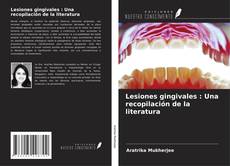 Bookcover of Lesiones gingivales : Una recopilación de la literatura