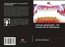 Bookcover of Lésions gingivales : Un recueil de la littérature