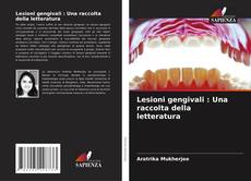 Bookcover of Lesioni gengivali : Una raccolta della letteratura