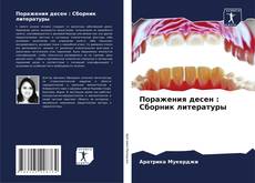 Bookcover of Поражения десен : Сборник литературы