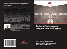 Talipes Equinovarus congénitaux en Egypte kitap kapağı