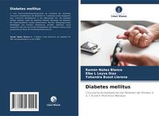 Bookcover of Diabetes mellitus