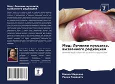 Мед: Лечение мукозита, вызванного радиацией的封面