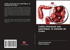 Copertina di Colite ulcéreuse non spécifique. la maladie de Crohn