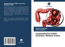 Unspezifische Colitis ulcerosa. Morbus Crohn的封面