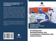 Bookcover of Prothetische Rehabilitation von erworbenen Defekten des Unterkiefers