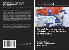 Bookcover of Rehabilitación protésica de defectos adquiridos de la mandíbula
