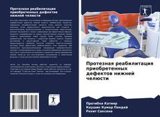 Borítókép a  Протезная реабилитация приобретенных дефектов нижней челюсти - hoz