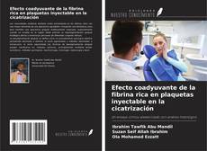 Capa do livro de Efecto coadyuvante de la fibrina rica en plaquetas inyectable en la cicatrización 