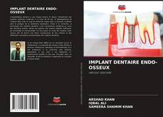 Bookcover of IMPLANT DENTAIRE ENDO-OSSEUX