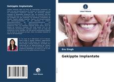 Gekippte Implantate kitap kapağı