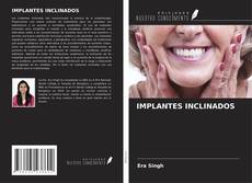 IMPLANTES INCLINADOS kitap kapağı