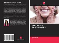 Buchcover von IMPLANTES BASCULANTES
