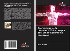 Capa do livro de Espressione della proteina CD20 e terapia anti CD 20 nel linfoma canceroso 