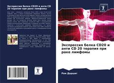 Buchcover von Экспрессия белка CD20 и анти CD 20 терапия при раке лимфомы