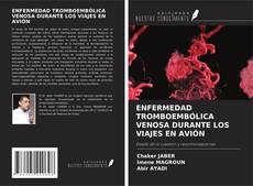 Bookcover of ENFERMEDAD TROMBOEMBÓLICA VENOSA DURANTE LOS VIAJES EN AVIÓN